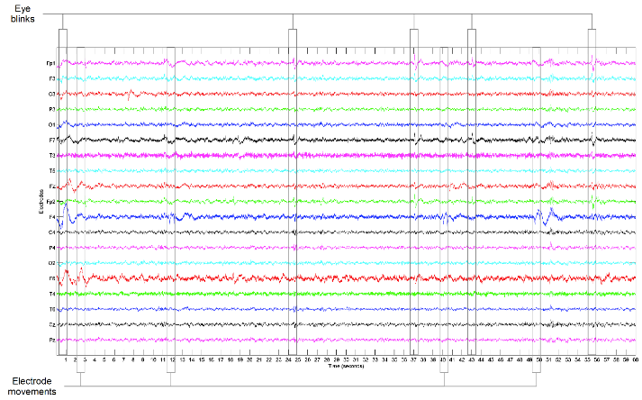 Exemple de EEG sur une minute